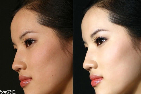 23歲應(yīng)該怎么護(hù)膚？不注意這3點(diǎn)你比閨蜜還顯老