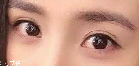 葉黃素能治療夜盲癥嗎？看什么類型的