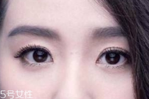 葉黃素會過敏嗎？一般不會的