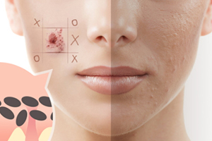 去角質(zhì)啫喱多久用一次？