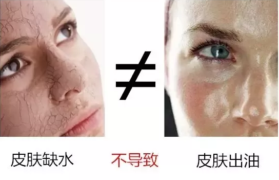 臉上外油內(nèi)干怎么辦 外油內(nèi)干的皮膚這樣護(hù)理 臉上外油內(nèi)干怎么辦 外油內(nèi)干的皮膚這樣護(hù)理