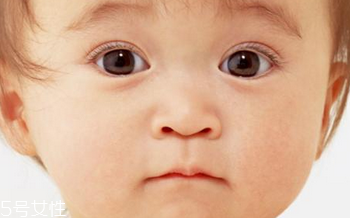 臉上有紅血絲的原因 這樣去除紅血絲 臉上有紅血絲的原因 這樣去除紅血絲