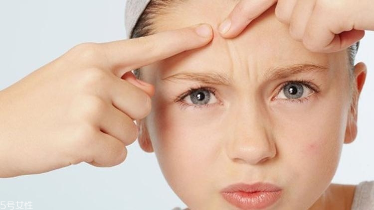 刷酸對(duì)痘痘有用嗎 這樣祛痘的妹紙痘痘都沒(méi)了 刷酸對(duì)痘痘有用嗎 這樣祛痘的妹紙痘痘都沒(méi)了