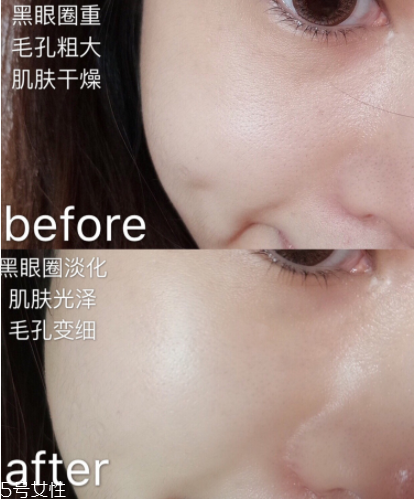 蘭蔻小黑瓶面膜怎么用 蘭蔻小黑瓶面膜要洗嗎 蘭蔻小黑瓶面膜怎么用 蘭蔻小黑瓶面膜要洗嗎