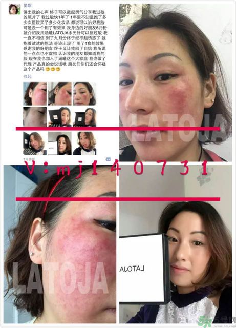 涵曦排毒針效果怎么樣？涵曦新品排毒針安全有副作用嗎？