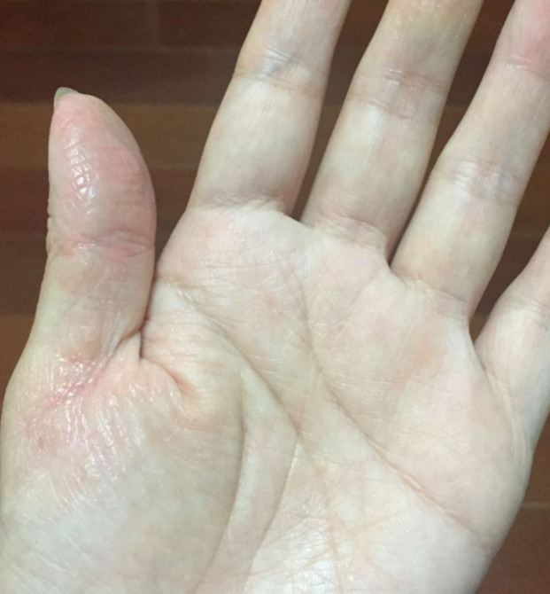 lucas木瓜膏怎么樣?lucas木瓜膏好用嗎? lucas木瓜膏怎么樣?lucas木瓜膏好用嗎?