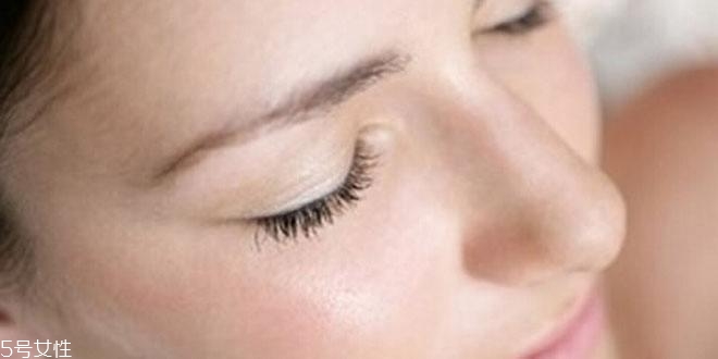 皮膚出油是因?yàn)轵x(chóng)嗎 臉上有螨蟲(chóng)的征兆 皮膚出油是因?yàn)轵x(chóng)嗎 臉上有螨蟲(chóng)的征兆