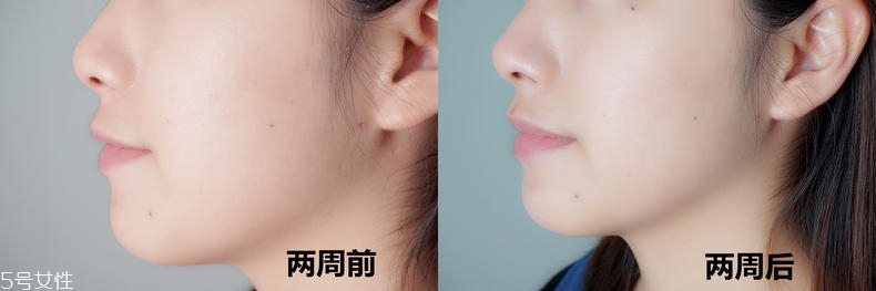 歐緹麗美白精華水怎么樣 歐緹麗美白精華水真人實測