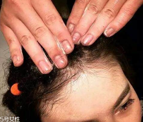 臟辮多久洗一次 臟辮是這樣養(yǎng)護(hù)的 臟辮多久洗一次 臟辮是這樣養(yǎng)護(hù)的