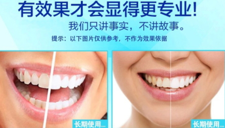 美白牙貼會(huì)反彈嗎？牙貼美白效果持續(xù)多久