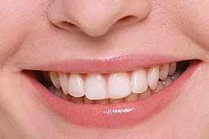 洗牙粉能把牙洗白嗎？洗牙粉有效嗎