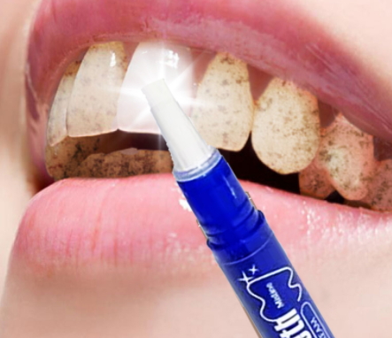 美牙筆怎么用？美牙筆使用步驟