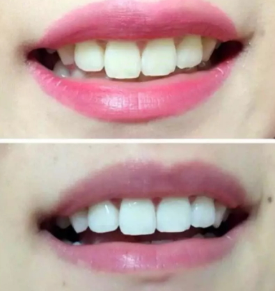 mistine美牙筆怎么用？mistine美牙筆評測