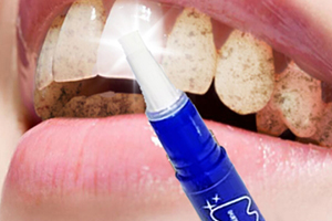 mistine美牙筆怎么用？mistine美牙筆評測