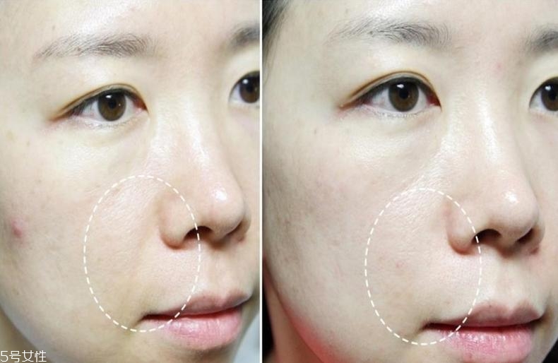 萊珀妮魚子緊顏液適合什么人 LP藍魚子精華推薦膚質 萊珀妮魚子緊顏液適合什么人 LP藍魚子精華推薦膚質