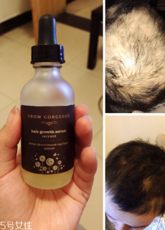 生發(fā)精油每次用多少 生發(fā)精油一次用量 生發(fā)精油每次用多少 生發(fā)精油一次用量