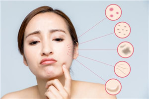 為什么皮膚白不起來 為什么皮膚有時候白有時候黑 為什么皮膚白不起來 為什么皮膚有時候白有時候黑