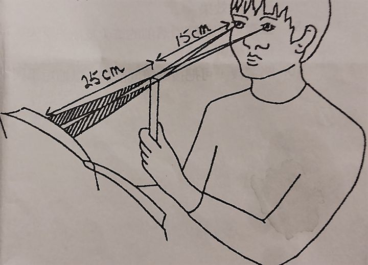 斜視是什么意思 斜視帶來(lái)生活的影響 斜視是什么意思 斜視帶來(lái)生活的影響