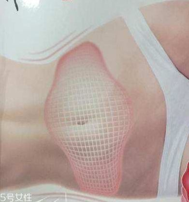 瘦身貼什么時候用最好？瘦身貼最佳使用時間