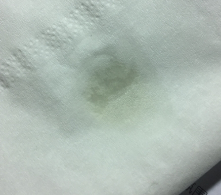 天竺葵精油可以去黑頭嗎？天竺葵精油怎么去黑頭