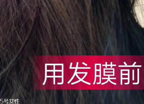 醫(yī)采發(fā)膜怎么樣 醫(yī)采發(fā)膜使用前后對(duì)比圖 醫(yī)采發(fā)膜怎么樣 醫(yī)采發(fā)膜使用前后對(duì)比圖