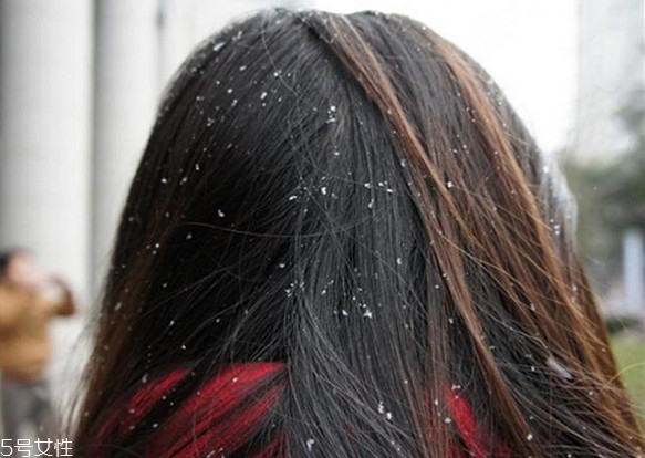 洗了頭發(fā)不吹干好嗎 頭發(fā)不吹干睡覺(jué)的危害 洗了頭發(fā)不吹干好嗎 頭發(fā)不吹干睡覺(jué)的危害