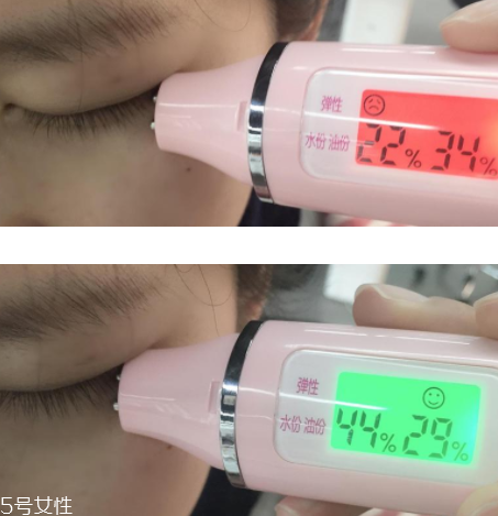 菲洛嘉眼霜敏感肌能用嗎 菲洛嘉360眼霜真人實(shí)測(cè) 菲洛嘉眼霜敏感肌能用嗎 菲洛嘉360眼霜真人實(shí)測(cè)