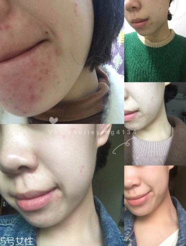 伊索綠茶平衡調(diào)理液和無油精華露哪個好 伊索綠茶平衡調(diào)理液和無油精華露哪個好