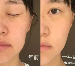 童顏機(jī)有用嗎？童顏機(jī)的功效