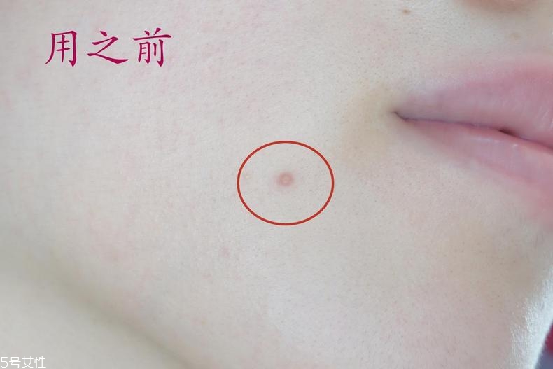 雅詩蘭黛晶透沁白防曬搖搖乳成膜快嗎？適合油痘皮嗎？