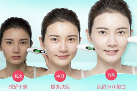 祛斑面膜的自制方法 祛斑面膜diy 祛斑面膜的自制方法 祛斑面膜diy