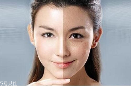 刷酸時要注意什么 刷酸去閉口操作指南 刷酸時要注意什么 刷酸去閉口操作指南