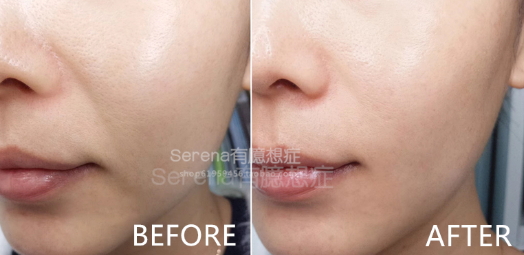 dermawand逆齡射頻注氧棒怎么用？