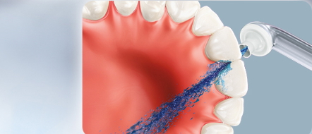 飛利浦沖牙器使用方法 飛利浦沖牙器怎么拆卸 飛利浦沖牙器使用方法 飛利浦沖牙器怎么拆卸
