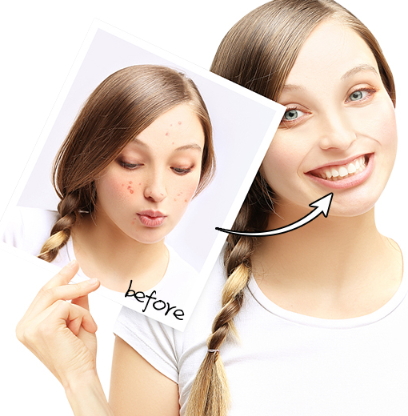 導(dǎo)出儀器真的有用嗎？導(dǎo)出儀的功效