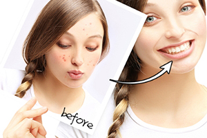 導(dǎo)出儀臟東西是真的嗎？導(dǎo)出儀騙局