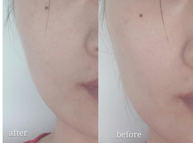 ulike美容儀怎么用？ulike美容儀充電