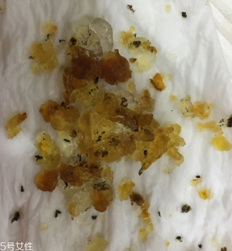 桃膠能和雞蛋一起吃嗎？桃膠配雞蛋可以嗎？