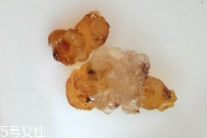 桃膠可以用開(kāi)水泡嗎？用開(kāi)水泡桃膠好嗎？