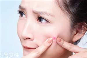 長痘痘可以涂v7素顏霜嗎 有痘痘了怎么恢復(fù) 長痘痘可以涂v7素顏霜嗎 有痘痘了怎么恢復(fù)