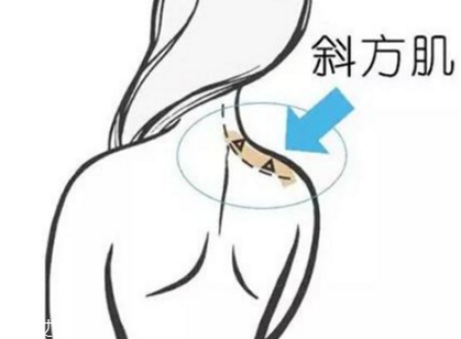 瘦肩針間隔多久打一次？打瘦肩針間隔時(shí)間