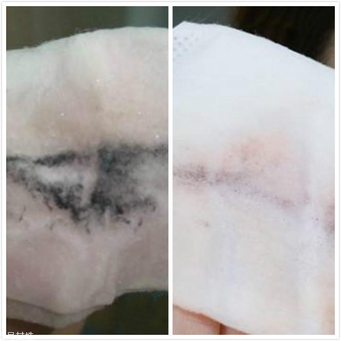 notime美容儀真的有效嗎 notime美容儀2個(gè)月親測(cè) notime美容儀真的有效嗎 notime美容儀2個(gè)月親測(cè)