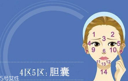 臉上各部位長(zhǎng)痘痘圖解 快速祛痘的簡(jiǎn)單方法 臉上各部位長(zhǎng)痘痘圖解 快速祛痘的簡(jiǎn)單方法