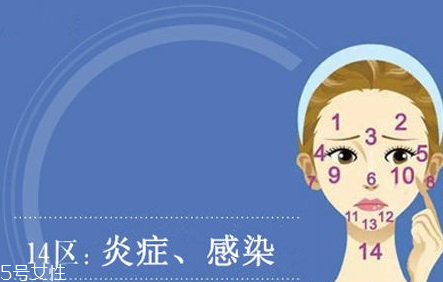 臉上各部位長(zhǎng)痘痘圖解 快速祛痘的簡(jiǎn)單方法 臉上各部位長(zhǎng)痘痘圖解 快速祛痘的簡(jiǎn)單方法