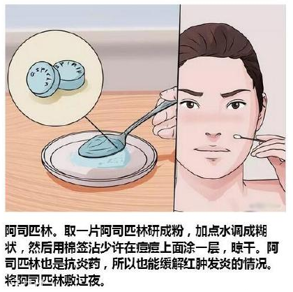 臉上各部位長(zhǎng)痘痘圖解 快速祛痘的簡(jiǎn)單方法 臉上各部位長(zhǎng)痘痘圖解 快速祛痘的簡(jiǎn)單方法