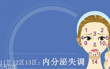 臉上各部位長(zhǎng)痘痘圖解 快速祛痘的簡(jiǎn)單方法 臉上各部位長(zhǎng)痘痘圖解 快速祛痘的簡(jiǎn)單方法