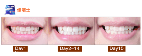 佳潔士一天美白牙貼真的能美白嗎 佳潔士美白牙貼評測 佳潔士一天美白牙貼真的能美白嗎 佳潔士美白牙貼評測