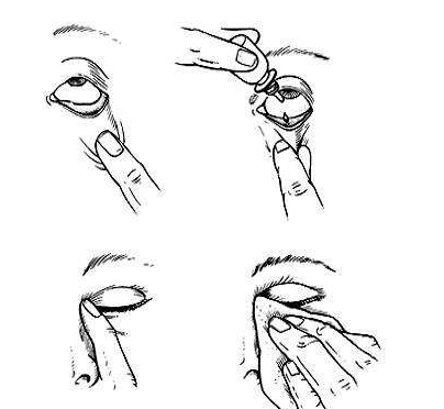 眼藥水兒童可以用嗎？眼藥水適合兒童用嗎？