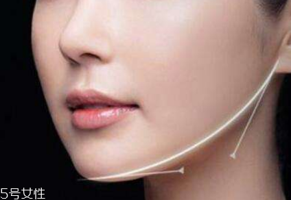 粉毒瘦臉針能維持多久？粉毒瘦臉針能保持多長時間