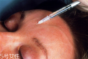 水光針和美白針哪個(gè)好 水光針和美白針能一起打嗎 水光針和美白針哪個(gè)好 水光針和美白針能一起打嗎